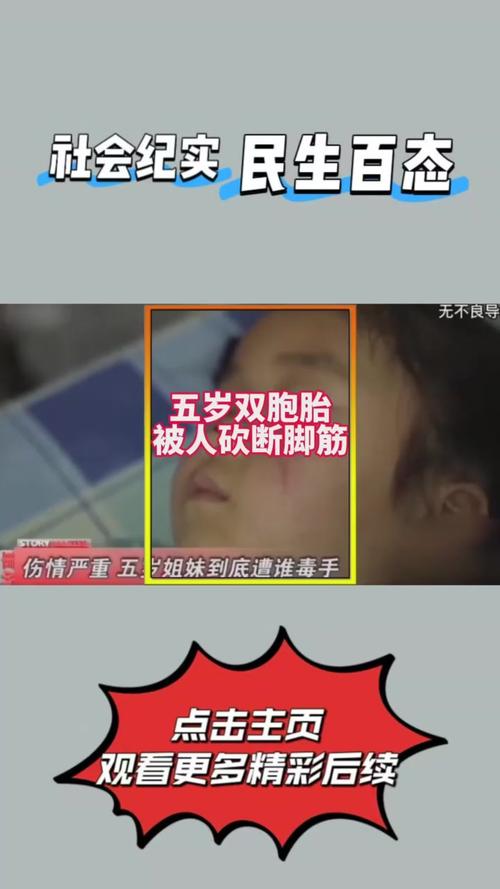 过去三年五遭腿筋重伤！TA谈阿利森伤病：技术动作存在不合理