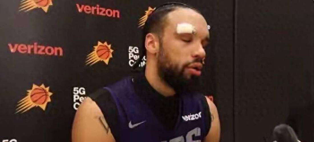 明日对阵灰熊！太阳官方：杰伦-格林出战成疑 狄龙缺席